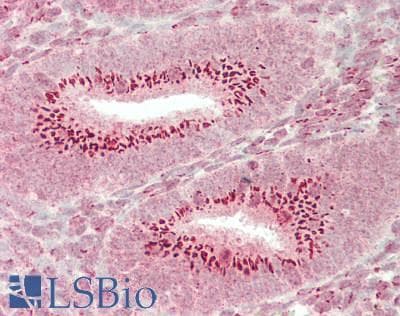 IHC-plus™ DFFA / ICAD / DFF45 Antibody