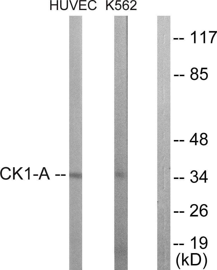 CSNK1A1 / CK1 Alpha Antibody (p321)
