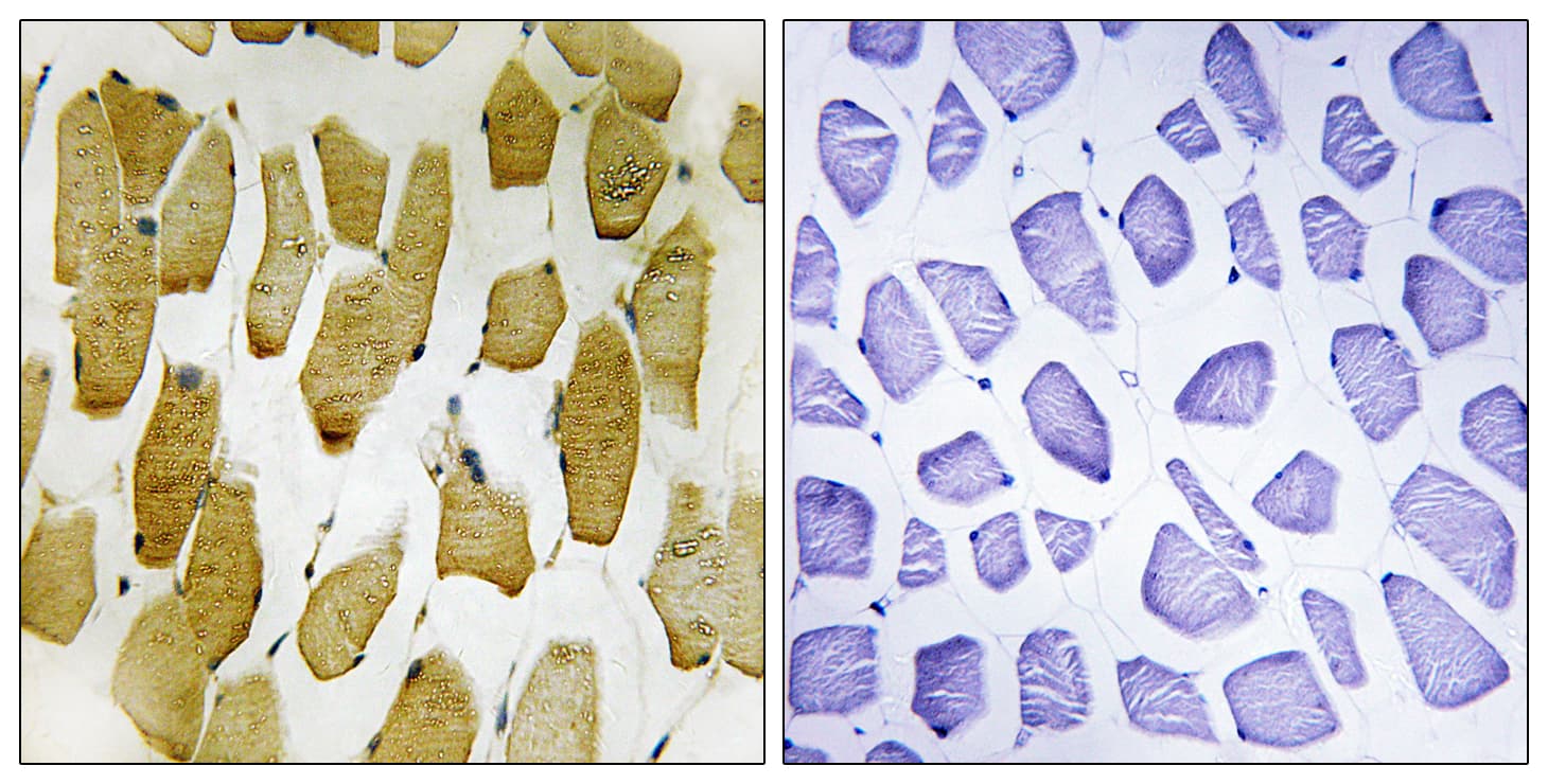 ALOX5 / 5-LOX Antibody (phospho-Ser271)