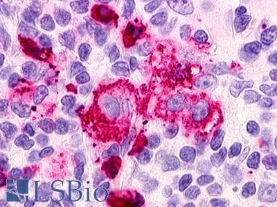 PathPlus™ Polyclonal Rabbit anti-Human RAIG2 / GPRC5B Antibody (C-Terminus, IHC)