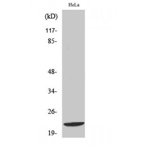 Polyclonal Rabbit anti-Human GBTS1 / DIRAS1 Antibody (120-200 aa, C-terminal, IHC, IF, WB)