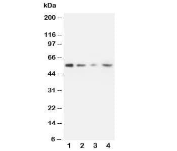 Polyclonal Rabbit anti-Human MMP10 Antibody (aa410-422, WB)