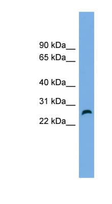 FAM3D Antibody (aa143-192)