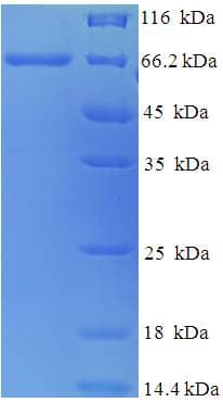Canine Distemper Virus Fusion Glycoprotein F0 (Recombinant His-SUMO)