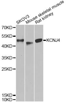 Polyclonal Rabbit anti-Human KCNJ4 / Kir2.3 Antibody (IHC, WB)