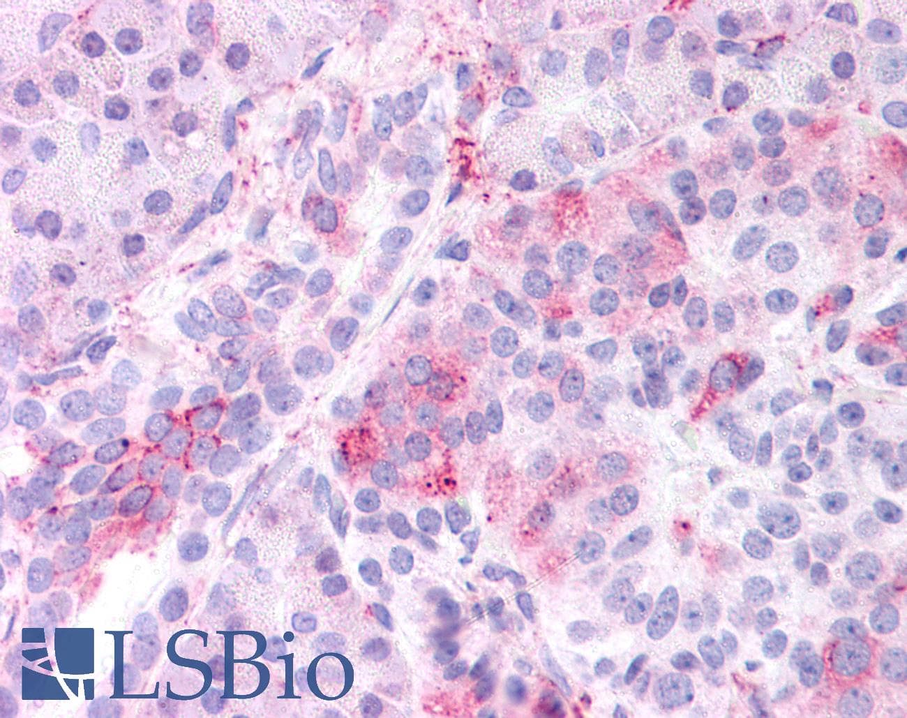 IHC-plus™ KCNMB3 Antibody (Internal)