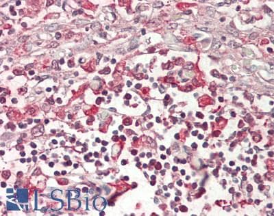 IHC-plus™ ABCG1 Antibody (560-640 aa, C-terminal)