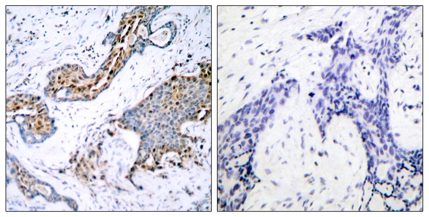 Polyclonal Rabbit anti-Human ER Alpha / Estrogen Receptor Antibody (phospho-Ser118, IHC, WB)
