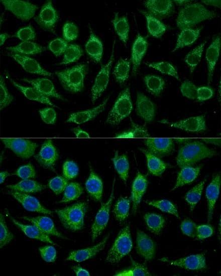 ABCD2 / ALDR Antibody