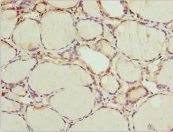 Polyclonal Rabbit anti-Human WDR47 Antibody (IHC)