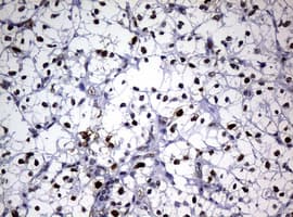 Monoclonal Mouse anti-Human PCNA Antibody (clone OTI1D11, IHC, WB)