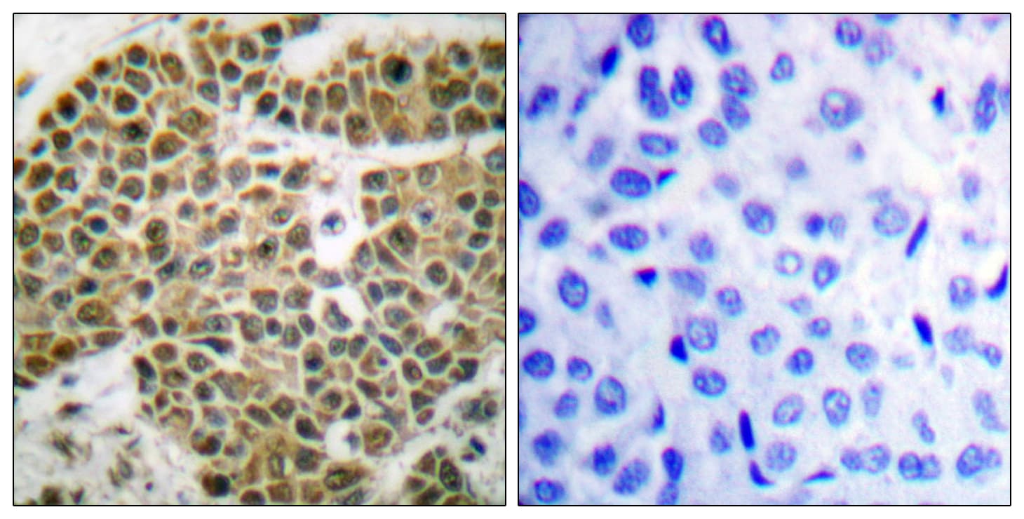 NFKB1 / NF-Kappa-B Antibody (aa896-945)