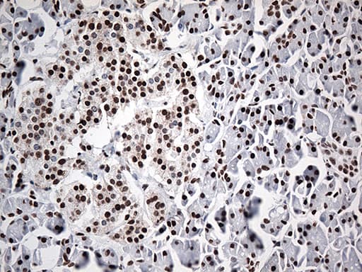 Monoclonal Mouse anti-Human EWSR1 / EWS Antibody (clone OTI3F6, aa256-447, IHC, IF, WB)