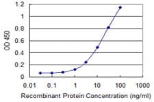 PGM1 / Phosphoglucomutase 1 Antibody (clone 3B8-H4)
