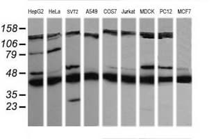 MAP2K1 / MKK1 / MEK1 Antibody (clone OTI2D2)