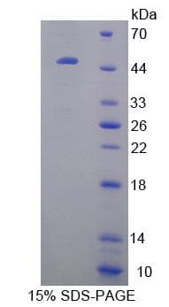 Mouse CRYBB1 Protein (Recombinant His-GST)