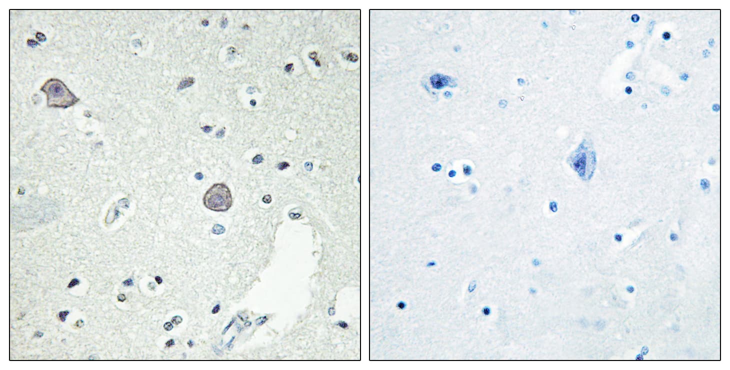 DRD1 / Dopamine Receptor D1 Antibody (aa135-184)