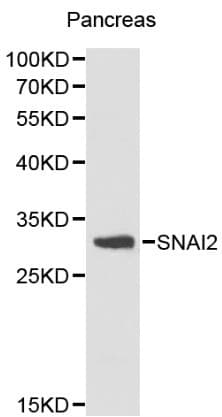 Polyclonal Rabbit anti-Human SNAI2 / SLUG Antibody (IHC, WB)