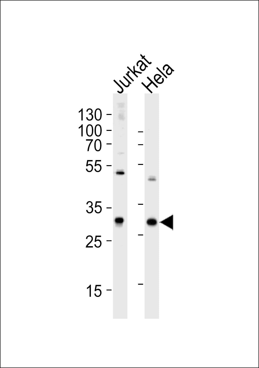 Polyclonal Rabbit anti-Human CAPZB / CAPZ Beta Antibody (aa54-81, WB)