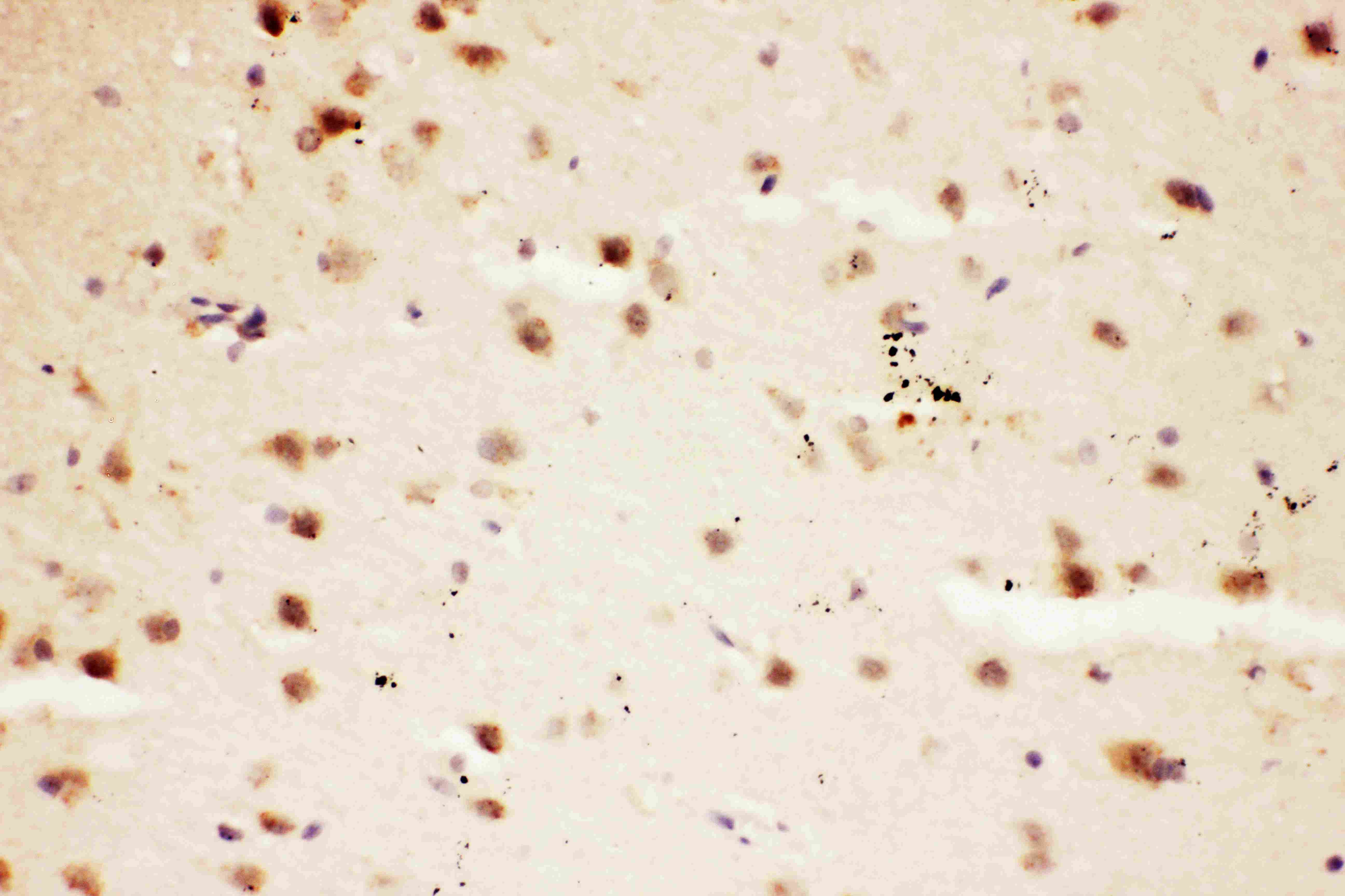 GRIN2A / NMDAR2A / NR2A Antibody (aa1411-1427)