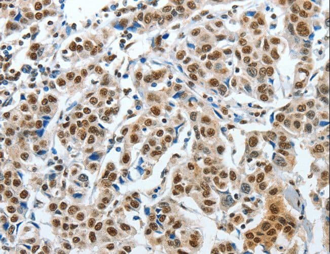 CREB1 / CREB Antibody