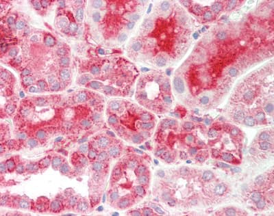 Polyclonal Rabbit anti-Human TXN2 / Thioredoxin 2 Antibody (C-Terminus, IHC, WB)