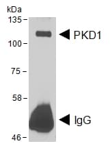 Polyclonal Goat anti-Human PRKD1 / PKC Mu Antibody (aa233-246, IHC, WB)