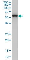 OXSR1 / OSR1 Antibody (clone 3A8)