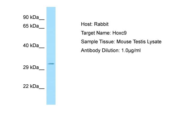 Polyclonal Rabbit anti-Mouse HOXC9 Antibody (C-Terminus, WB)