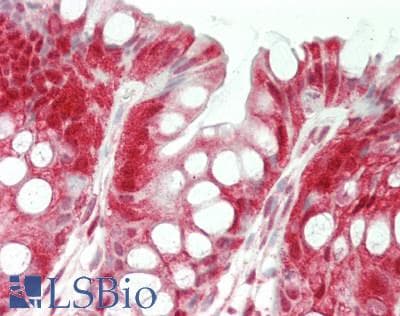 IHC-plus™ OTUB1 / OTU1 Antibody (aa1-40)