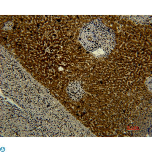 TF / Transferrin Antibody