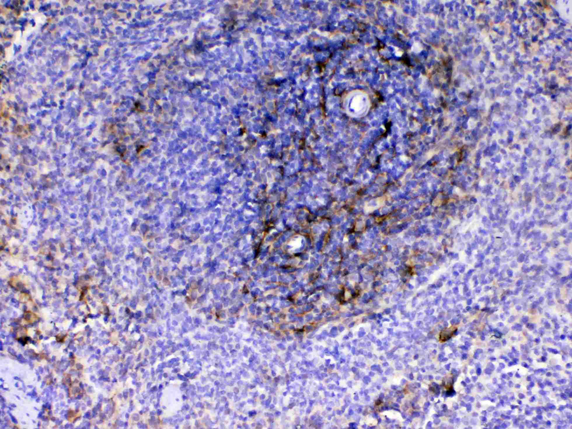 VCAM1 / CD106 Antibody