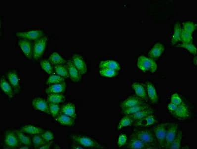 IHC-plus™ Polyclonal Rabbit anti-Human KNG1 / Kininogen / Bradykinin Antibody (IHC, WB)