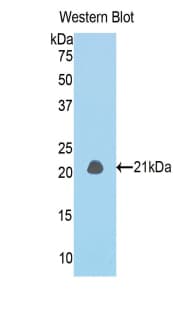 IVL / Involucrin Antibody (aa301-460)