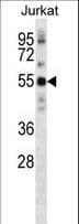 IHC-plus™ NETO2 Antibody (aa174-203)