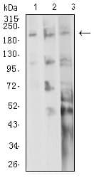 Monoclonal Mouse anti-Human ITGB4 / Integrin Beta 4 Antibody (clone 5G3G5, IHC, WB)