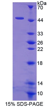 Human HBD / Hemoglobin Delta Protein (Recombinant His-GST-S)