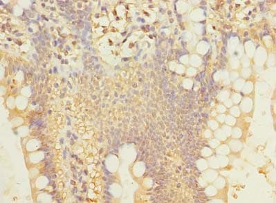 Polyclonal Rabbit anti-Human SIPA1L2 Antibody (IHC)