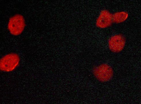 ER Alpha / Estrogen Receptor Antibody