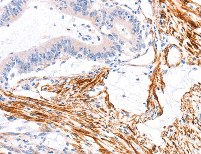 Polyclonal Rabbit anti-Human CENTD2 / ARAP1 Antibody (IHC)
