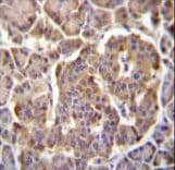 PIK3CB / PI3K Beta Antibody (aa124-154)