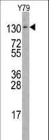 ABL2 Antibody (aa417-446)