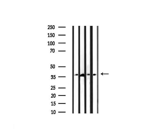 CASP3 / Caspase 3 Antibody