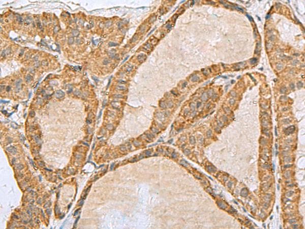 PREPL Antibody
