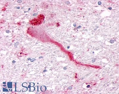 PathPlus™ SGK3 Antibody (N-Terminus)