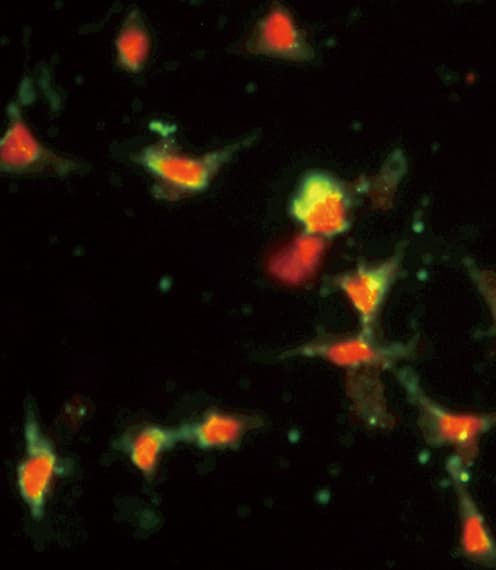 IHC-plus™ CCL2 / MCP1 Antibody (aa62-89)
