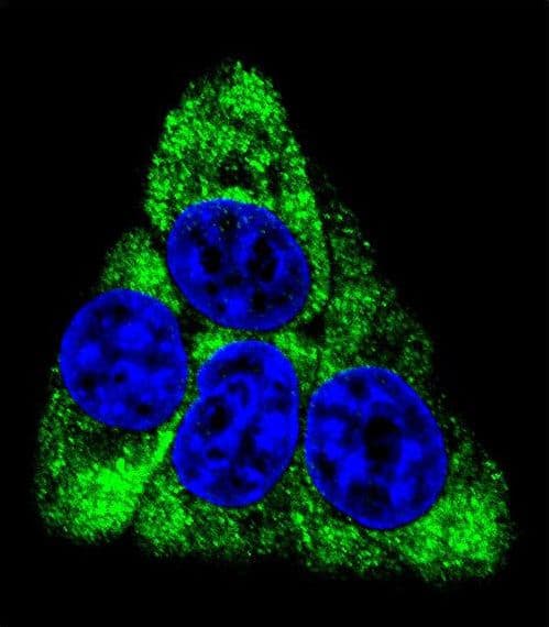 Polyclonal Rabbit anti-Human BCKDHB Antibody (aa41-70, IHC, IF, WB)