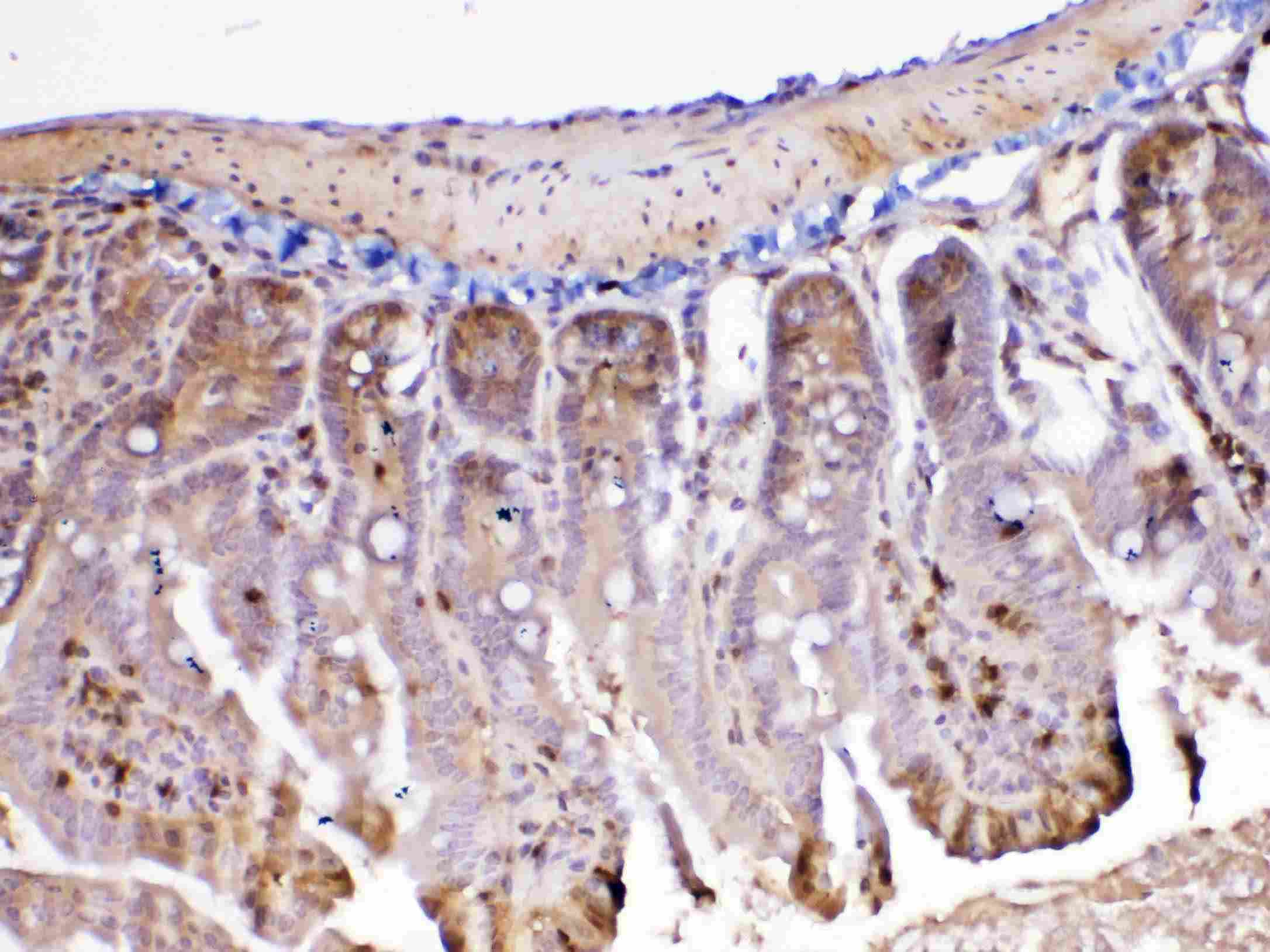 Polyclonal Rabbit anti-Rat ADA / Adenosine Deaminase Antibody (IHC, WB)