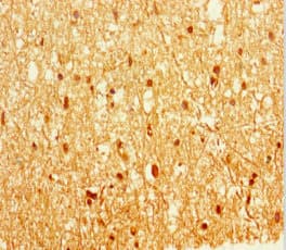 EPM2A / Laforin Antibody