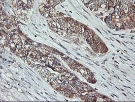 Monoclonal Mouse anti-Human PTP1B Antibody (clone OTI1C5, IHC, WB)
